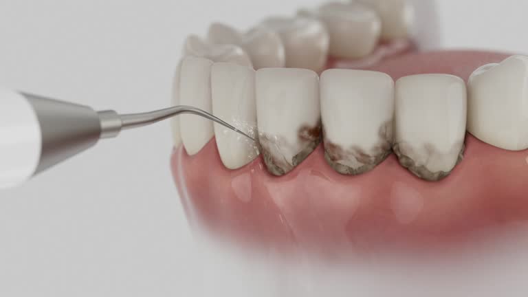 Trusted Teeth Cleaning And Checkup service in Georgetown, CA - Dentist Open Now